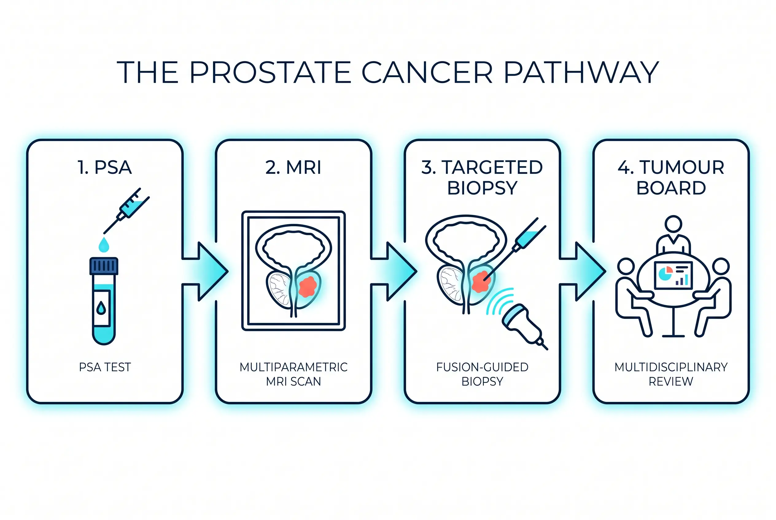 Medical diagram of the prostate cancer pathway: PSA blood test, MRI scan, targeted biopsy and multidisciplinary tumour board review