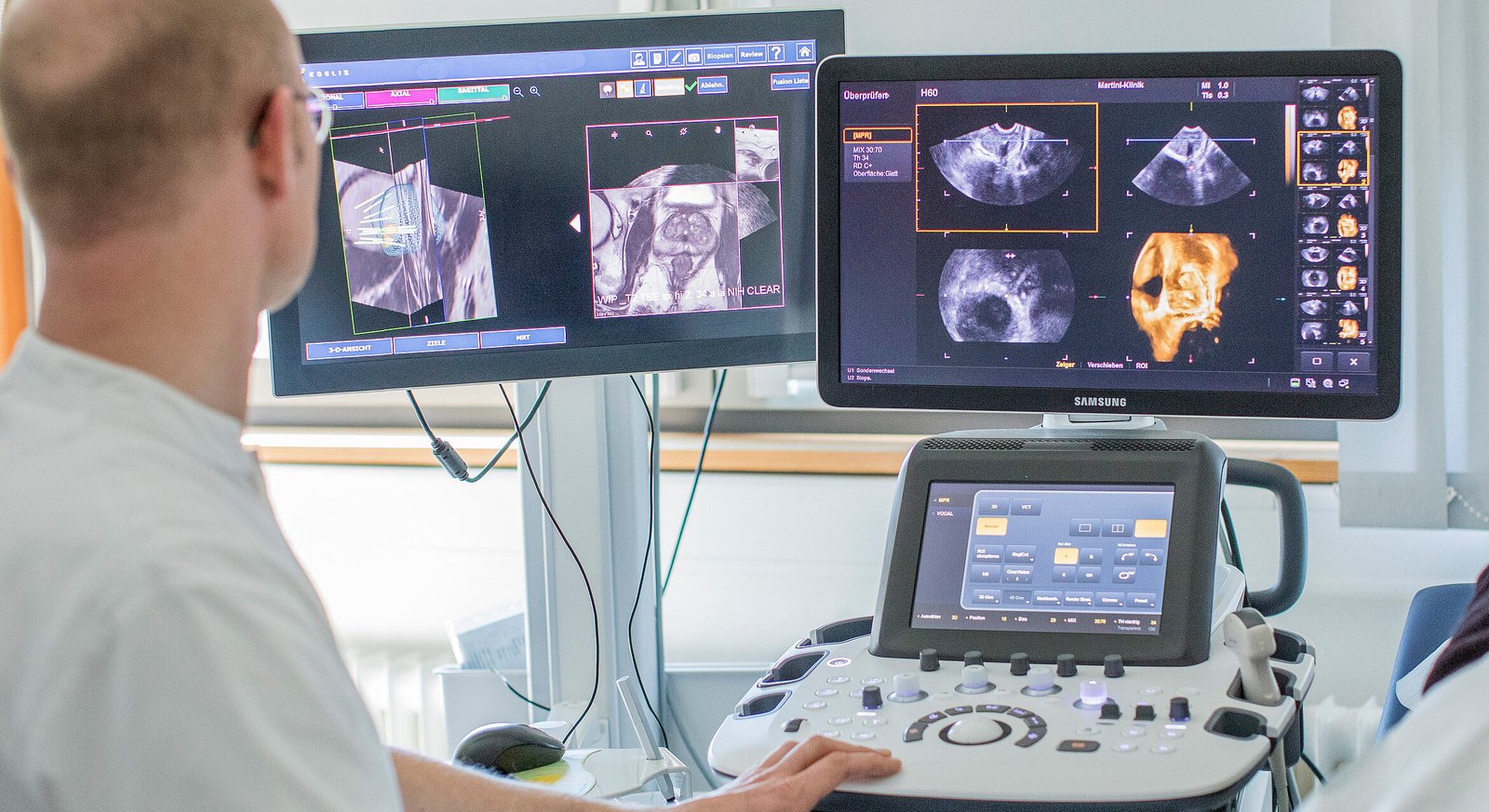 Multiparametric MRI and 3D ultrasound fusion imaging suite for targeted prostate biopsy in Istanbul